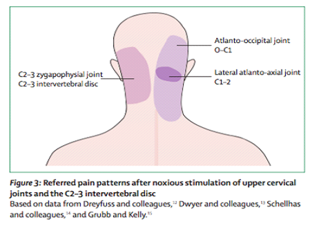 fattori di sofferenza cefalea tensiva